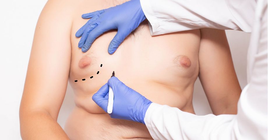 Dr Gardner on Gynecomastia