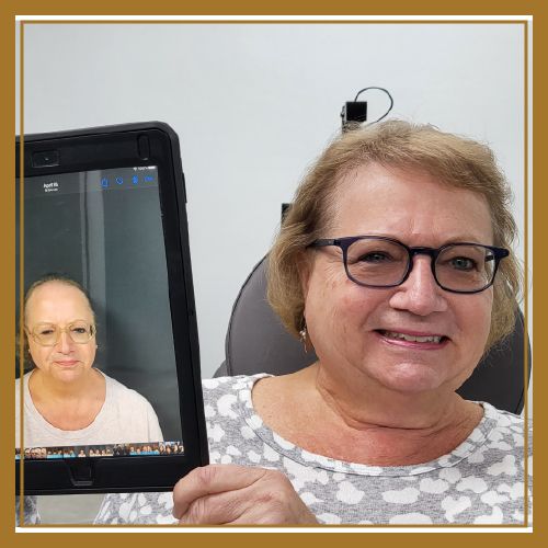 before and after naples female hair restoration