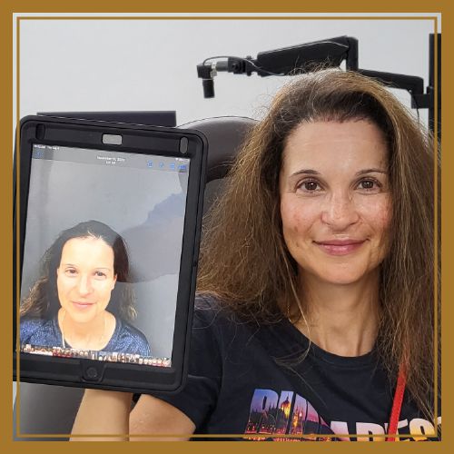 female before and after naples hair restoration