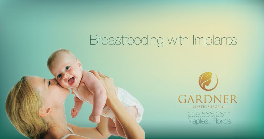 What You Need to Know About Breastfeeding with Implants