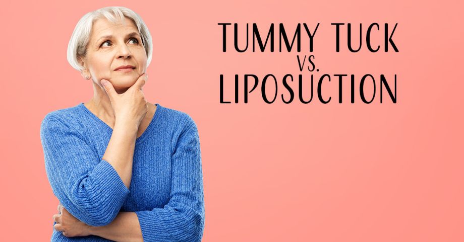 Tummy Tuck vs Liposuction