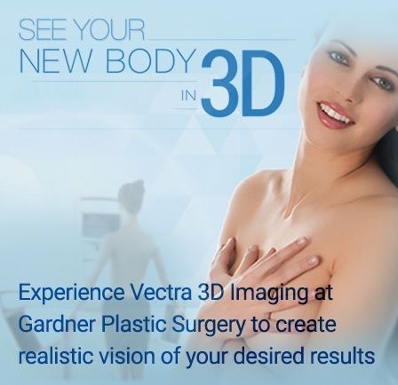 New body in 3D