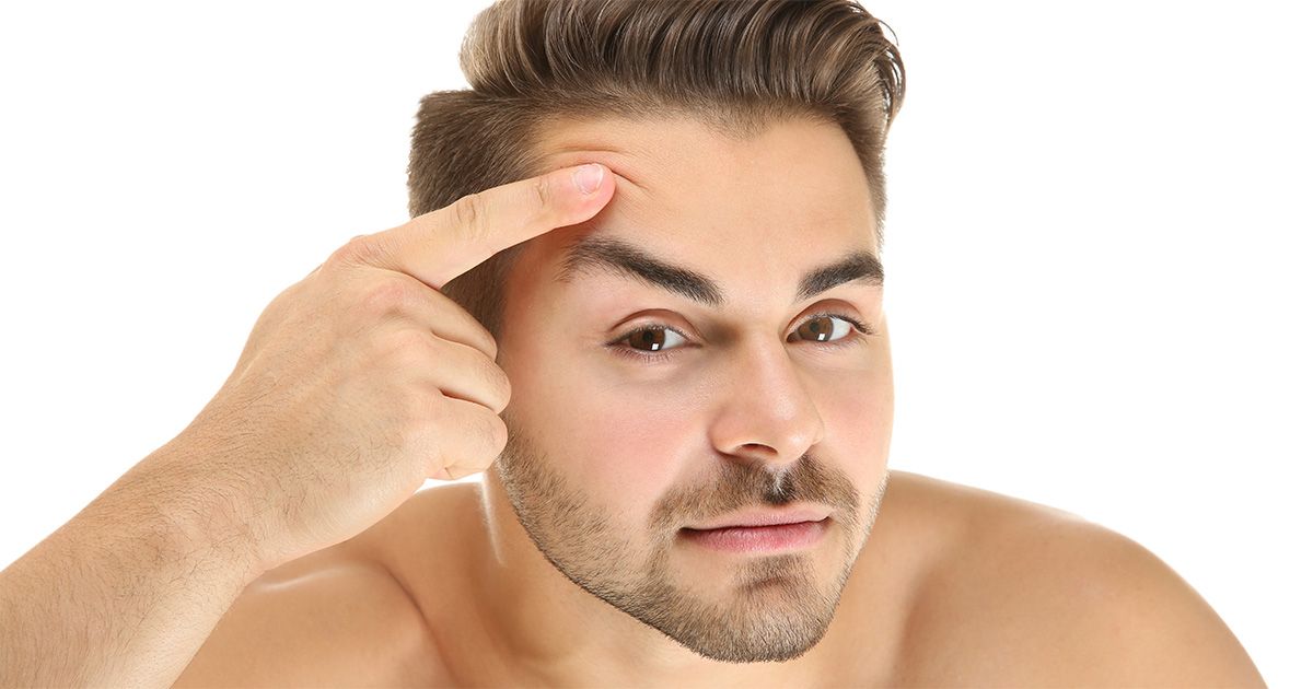 Your Male Eyelid Surgery