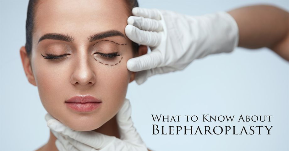 What to know about blepharoplasty