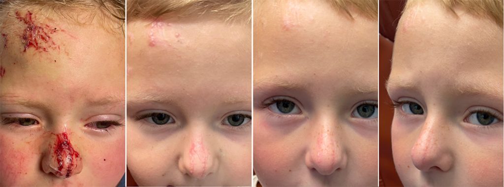 Dr. Bonett Silagen Scar Care
