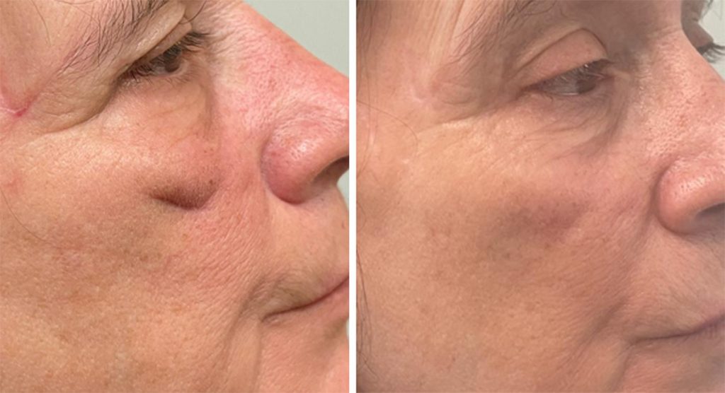 Dr. Bonett Silagen Scar Care