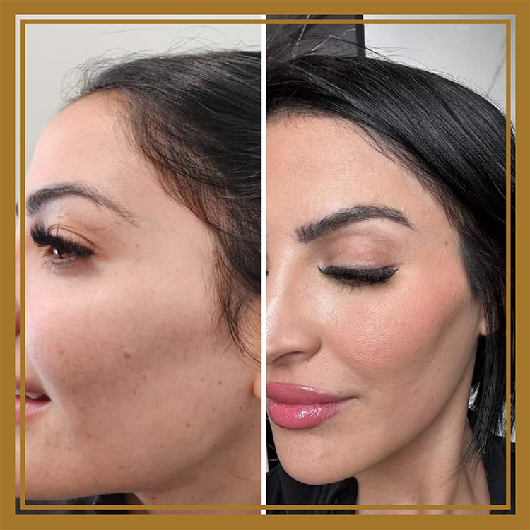 Hair Restoration by Dr. Wisiorek