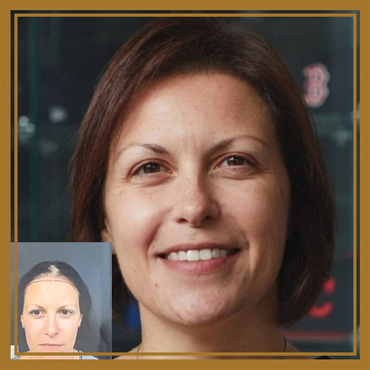 Hair Restoration by Dr. Wisiorek