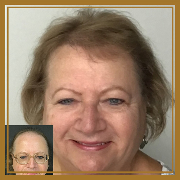 Hair Restoration by Dr. Wisiorek