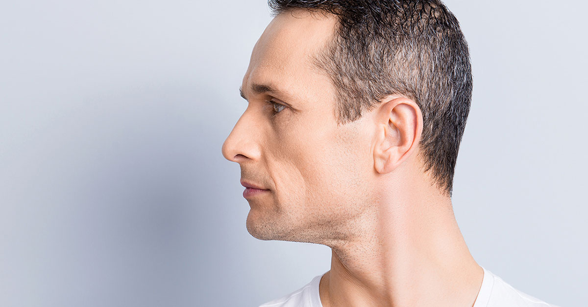 Rhinoplasty Procedures at Naples Plastic Surgery