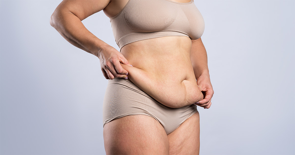 panniculectomy at naples plastic surgery