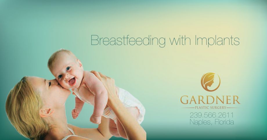 What You Need to Know About Breastfeeding with Implants