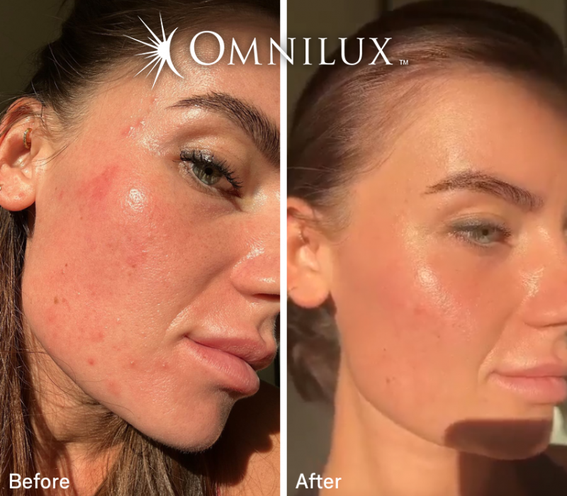 Omnilux red light therapy masks.
