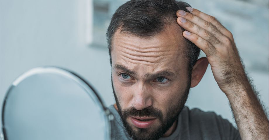 causes of Hair Loss
