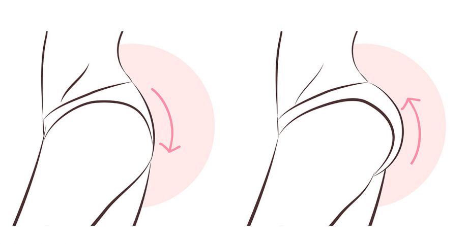 Dr Baccaro on Fat Transfers