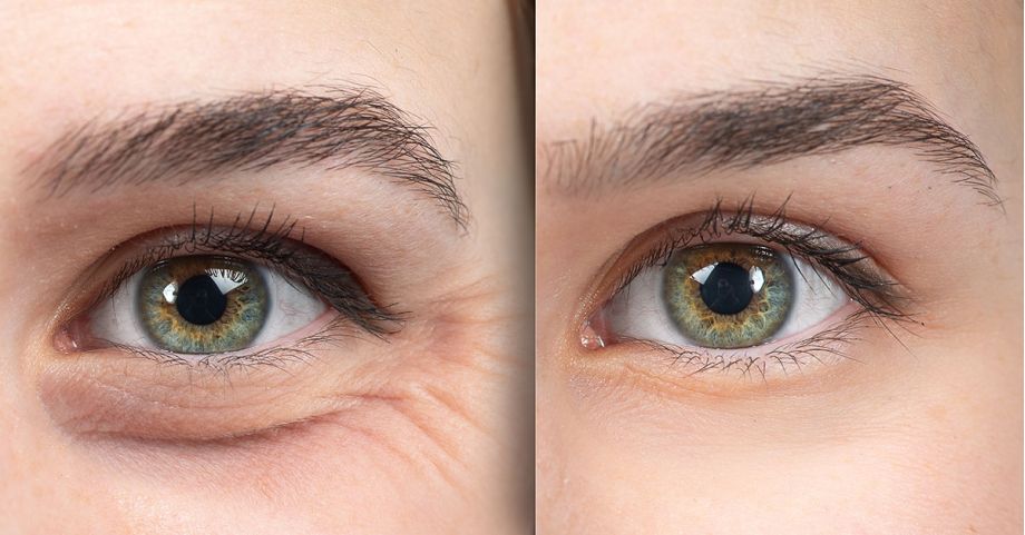 Dr Gardner Discusses Areas of Botox