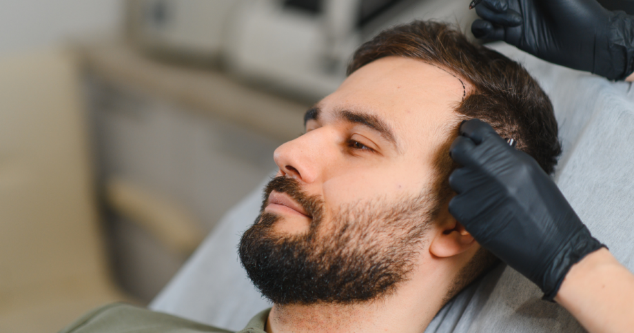 hair restoration Naples FL